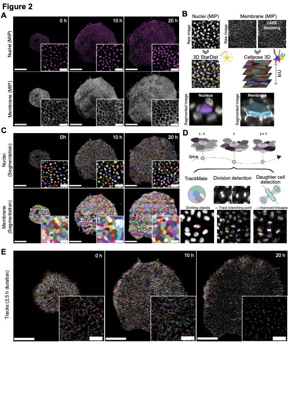 Figure 2: Segmentation Pipeline Overview